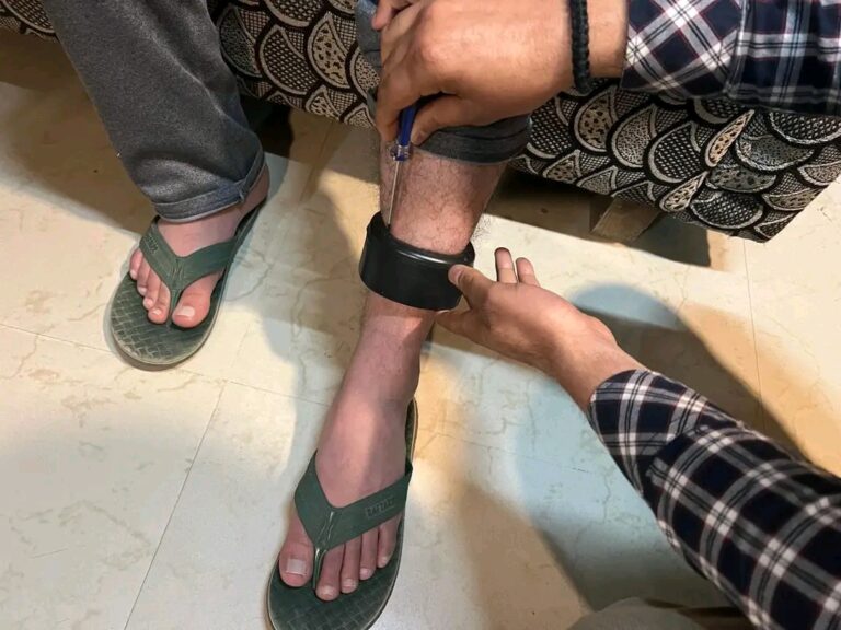 Handwara Police Implements GPS Anklet for Surveillance on UAPA Bailed Out Individual