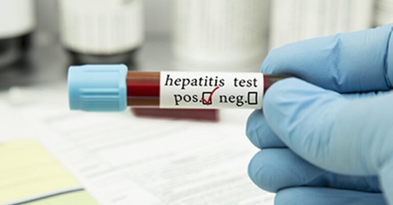 Hepatitis in Kulgam